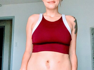 endometriosis coach chelsea donohue showcasing the scars on her abdomen